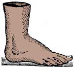 severed foot